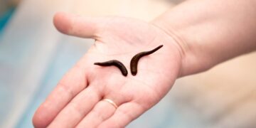 Что такое медицинские пиявки, их применение и лечебный эффект